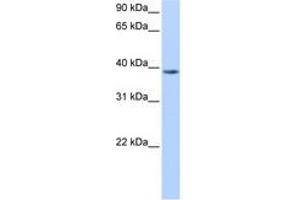 Image no. 1 for anti-Nudix (Nucleoside Diphosphate Linked Moiety X)-Type Motif 13 (NUDT13) (N-Term) antibody (ABIN6738501)