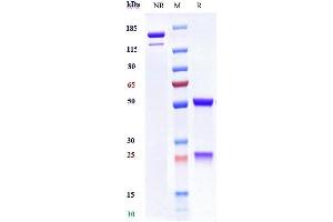 Anti-MICA Reference Antibody (CLN-619) on SDS-PAGE under reducing (R) condition.