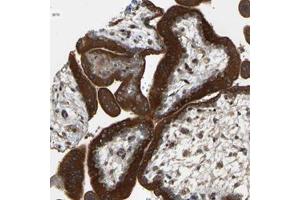 Immunohistochemical staining of human placenta with PTCD1 polyclonal antibody  shows strong cytoplasmic positivity in trophoblastic cells. (PTCD1 anticorps)