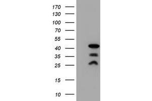 Western Blotting (WB) image for anti-PDZ and LIM Domain 2 (PDLIM2) antibody (ABIN1500127) (PDLIM2 anticorps)
