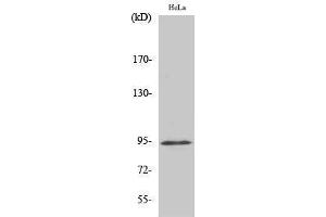 Western Blotting (WB) image for anti-Signal Transducer and Activator of Transcription 6, Interleukin-4 Induced (STAT6) (pTyr641) antibody (ABIN3182155) (STAT6 anticorps  (pTyr641))