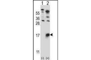 Western blot analysis of GYPB (arrow) using rabbit polyclonal GYPB Antibody (Center) (ABIN657621 and ABIN2846617). (CD235b/GYPB anticorps  (AA 22-51))