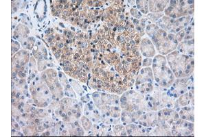 Immunohistochemical staining of paraffin-embedded Human Kidney tissue using anti-TTC32 mouse monoclonal antibody. (TTC32 anticorps)