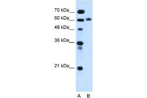 WB Suggested Anti-KIAA1754L Antibody Titration:  0.