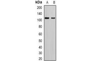 Western blot analysis of AP2-alpha-2 expression in SKOV3 (A), mouse brain (B) whole cell lysates.