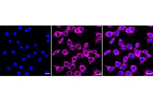 anti-Fibronectin 1 (FN1) antibody