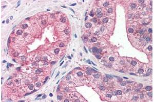 Prostate: Formalin-Fixed, Paraffin-Embedded (FFPE)
