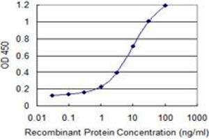 Detection limit for recombinant GST tagged LDOC1 is 0. (LDOC1 anticorps  (AA 1-146))