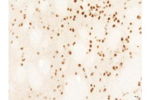 Rat LV-Htt171-82Q (800 ng) PFA 4% HTT Ab, 1/2,000 PBS-BSA 1% - 25 µm.