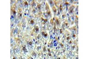 Used in DAB staining on fromalin fixed paraffin-embedded Liver tissue