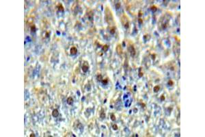 Used in DAB staining on fromalin fixed paraffin-embedded Liver tissue (SSRP1 anticorps  (AA 6-246))