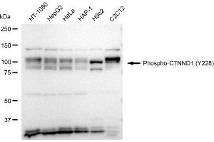 Western blotting analysis using Phospho-CTNND1 (Y228) antibody (ABIN7797935).