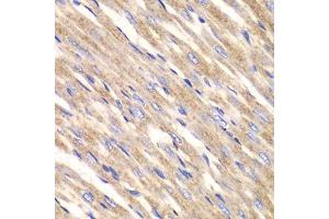 Immunohistochemistry of paraffin-embedded rat heart using SLC25A4 antibody.