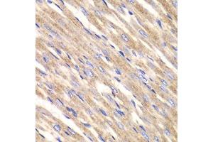 Immunohistochemistry of paraffin-embedded rat heart using SLC25A4 antibody. (SLC25A4 anticorps  (AA 40-298))