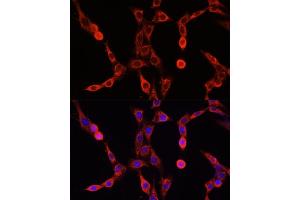 anti-ATP-Binding Cassette, Sub-Family D (Ald), Member 1 (ABCD1) (AA 340-500) antibody