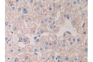 Detection of CRKL in Human Liver Tissue using Polyclonal Antibody to Crk Like Protein (CRKL) (CrkL anticorps  (AA 1-303))