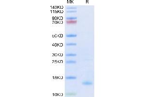 Biotinylated Human CXCL4 on Tris-Bis PAGE under reduced condition. (PF4 Protein (AA 32-101) (His-Avi Tag,Biotin))