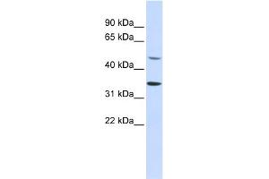 WB Suggested Anti-ZNF398 Antibody Titration:  0. (ZNF398 anticorps  (Middle Region))