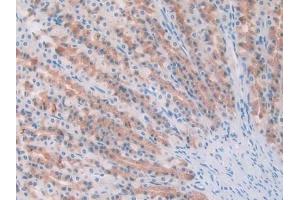 DAB staining on IHC-P; Samples: Rat Pancreas Tissue (IL1A anticorps  (AA 115-270))