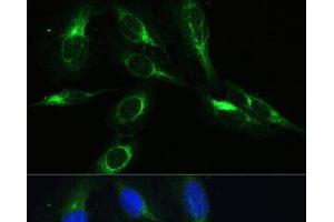 Immunofluorescence analysis of U-2 OS cells using BRK1 Polyclonal Antibody at dilution of 1:100.