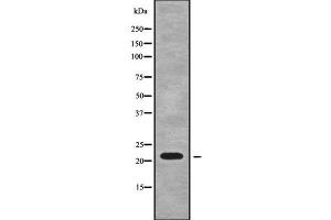 Western blot analysis of RPL18A using A549 whole cell lysates (RPL18A anticorps  (Internal Region))