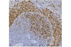 IHC analysis of CD79b using anti-CD79b antibody (ABIN7601115).