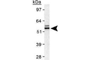 Western blot analysis of TERF2 in HeLa nuclear extract using TERF2 polyclonal antibody . (TRF2 anticorps)