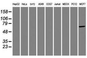 Image no. 5 for anti-Aryl Hydrocarbon Receptor Interacting Protein-Like 1 (AIPL1) antibody (ABIN1496508) (AIPL1 anticorps)