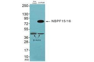 Western blot analysis of extracts from JK cells, using NBPF1/9/10/12/14/15/16/20 antibody. (NBPF12/NBPF1/NBPF1/NBPF9 anticorps)