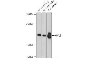 Western blot analysis of extracts of various cell lines using MYL9 Polyclonal Antibody at dilution of 1:1000. (MYL9 anticorps)