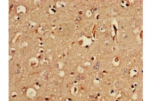 Immunohistochemistry of paraffin-embedded human brain tissue using ABIN7175662 at dilution of 1:100 (SORCS2 anticorps  (AA 712-786))