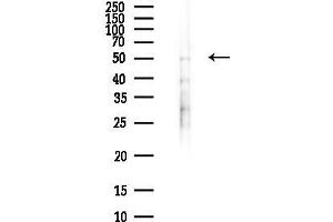 Western blot analysis of lysates from HUVEC cells(LPS,4h treatment), using ETNK1 Antibody at 1/1000 dilution.