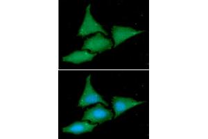 ICC/IF analysis of BAG2 in HeLa cells line, stained with DAPI (Blue) for nucleus staining and monoclonal anti-human BAG2 antibody (1:100) with goat anti-mouse IgG-Alexa fluor 488 conjugate (Green).