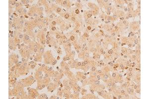 ABIN6267232 at 1/100 staining human liver tissue sections by IHC-P.