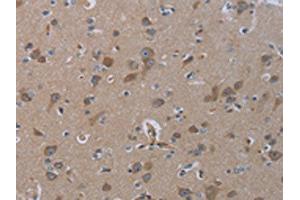 The image on the left is immunohistochemistry of paraffin-embedded Human brain tissue using ABIN7129900(INSIG2 Antibody) at dilution 1/30, on the right is treated with fusion protein. (INSIG2 anticorps)