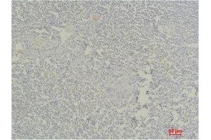 Immunohistochemistry (IHC) analysis of paraffin-embedded Human Tonsil Tissue using Stat4 Polyclonal Antibody. (STAT4 anticorps)