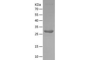 Galectin 3 (LGALS3) (AA 2-262) protein (His tag)