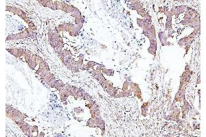 IHC analysis of EIF4A using anti-EIF4A antibody (ABIN7601309). (EIF4A1 anticorps  (AA 32-406))