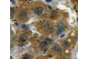 IHC-P analysis of Liver tissue, with DAB staining. (ACP1 anticorps  (AA 40-158))