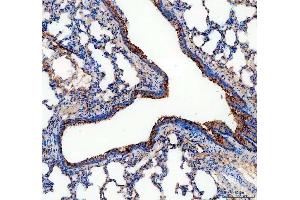 IHC analysis of ALDH1A3 using anti-ALDH1A3 antibody (ABIN5518802).