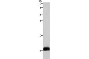 Gel: 10 % SDS-PAGE, Lysate: 40 μg, Lane: A549 cells, Primary antibody: ABIN7129016(COX6B2 Antibody) at dilution 1/500, Secondary antibody: Goat anti rabbit IgG at 1/8000 dilution, Exposure time: 5 seconds