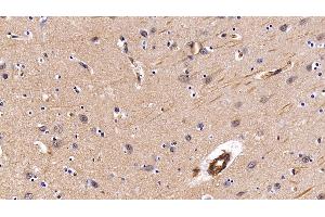 Detection of CAV1 in Porcine Cerebrum Tissue using Polyclonal Antibody to Caveolin 1 (CAV1)