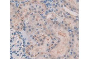 Used in DAB staining on fromalin fixed paraffin- embedded kidney tissue (FASTK anticorps  (AA 330-511))