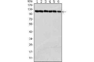 Western blot analysis using PARP mouse mAb against Jurkat (1), K562 (2), Hela (3), Raji (4),THP-1 (5) and SW620 (6) cell lysate. (PARP1 anticorps)