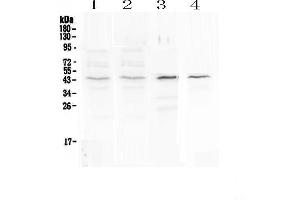 Western blot analysis of SP6 using anti-SP6 antibody .
