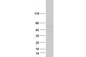 Validation with Western Blot