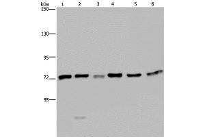 Western Blot analysis of K562, A549, HT-29, 293T, Hela and Jurkat cell using KARS Polyclonal Antibody at dilution of 1:350 (KARS anticorps)