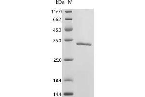 Glutathione S-Transferase mu 3 (Brain) (GSTM3) (AA 1-225), (full length) protein (His tag)