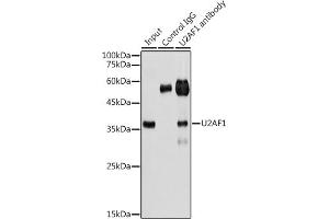Immunoprecipitation analysis of 300 μg extracts of HeLa cells using 3 μg U2 antibody (ABIN6134442, ABIN6149752, ABIN6149755 and ABIN6217061). (U2AF1 anticorps  (AA 1-100))