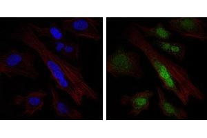 Image no. 1 for anti-SRY (Sex Determining Region Y)-Box 9 (SOX9) antibody (ABIN1501087)